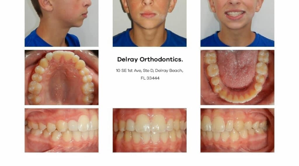 Delray Orthodontics Dental
