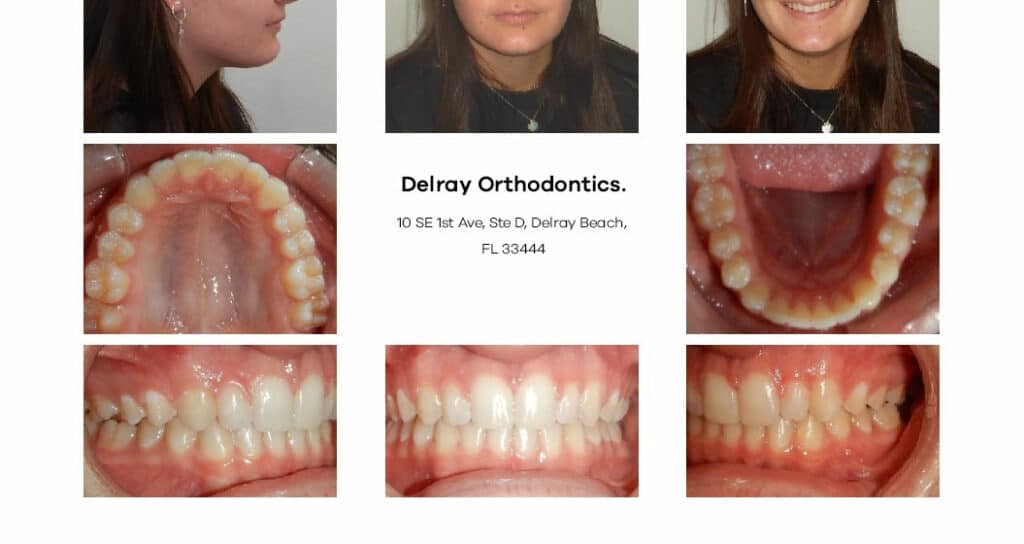 Delray Orthodontics Dental