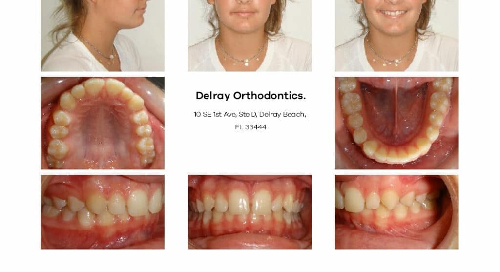 Delray Orthodontics Dental