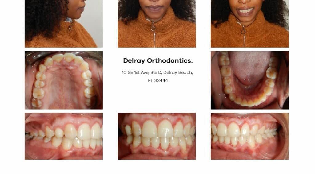 Delray Orthodontics Dental