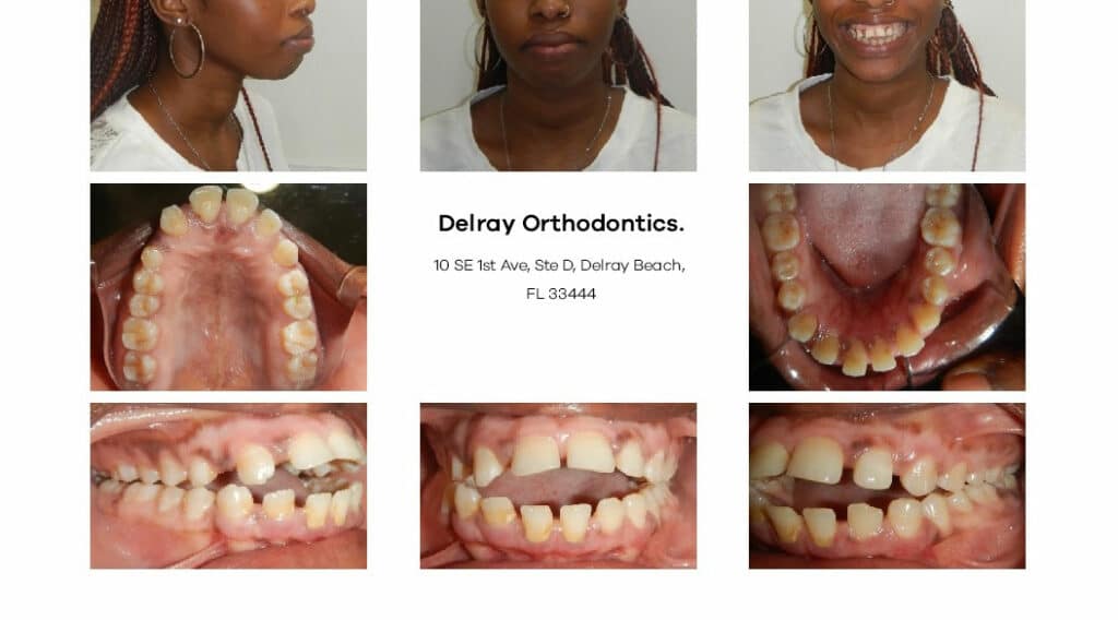 Delray Orthodontics Dental