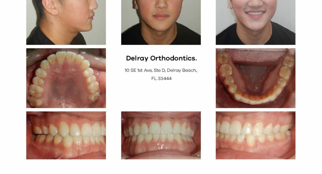 Delray Orthodontics Dental
