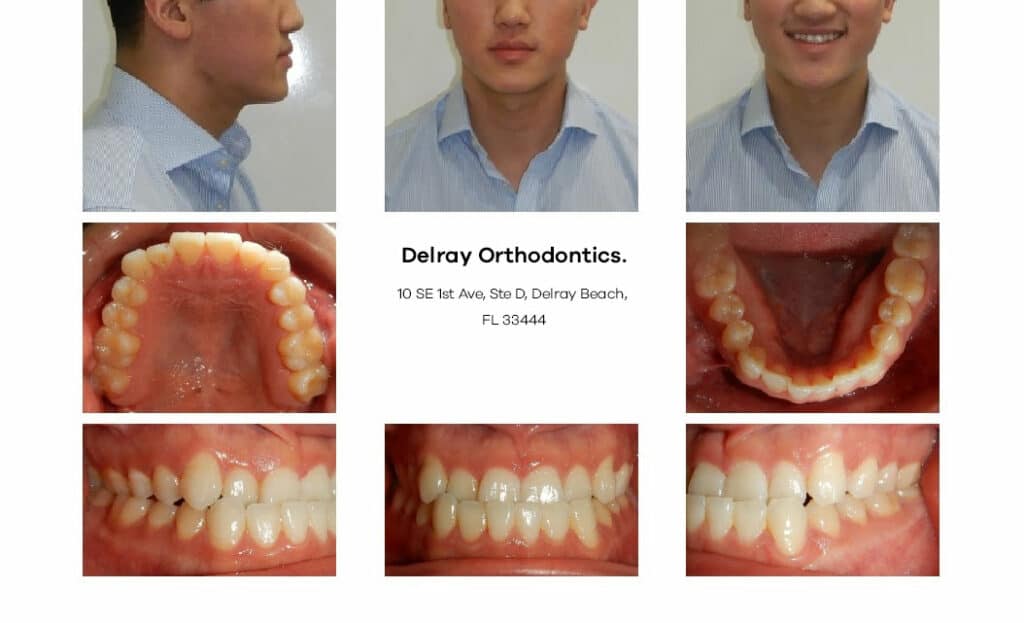 Delray Orthodontics Dental