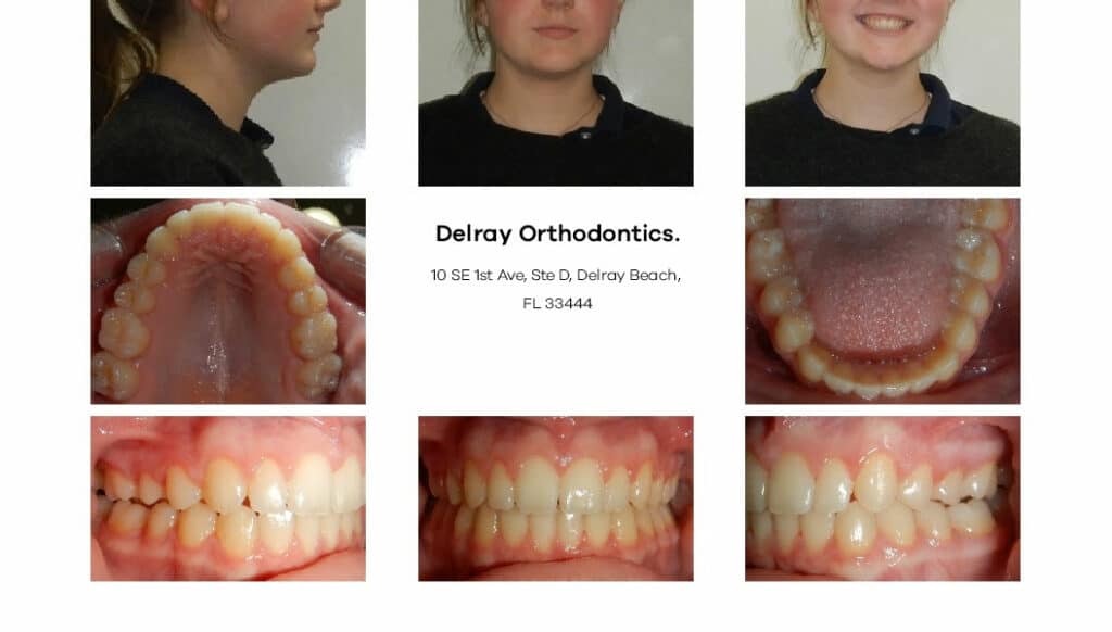 Delray Orthodontics Dental