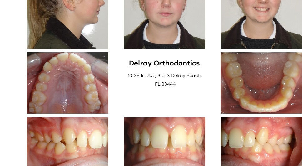 Delray Orthodontics Dental