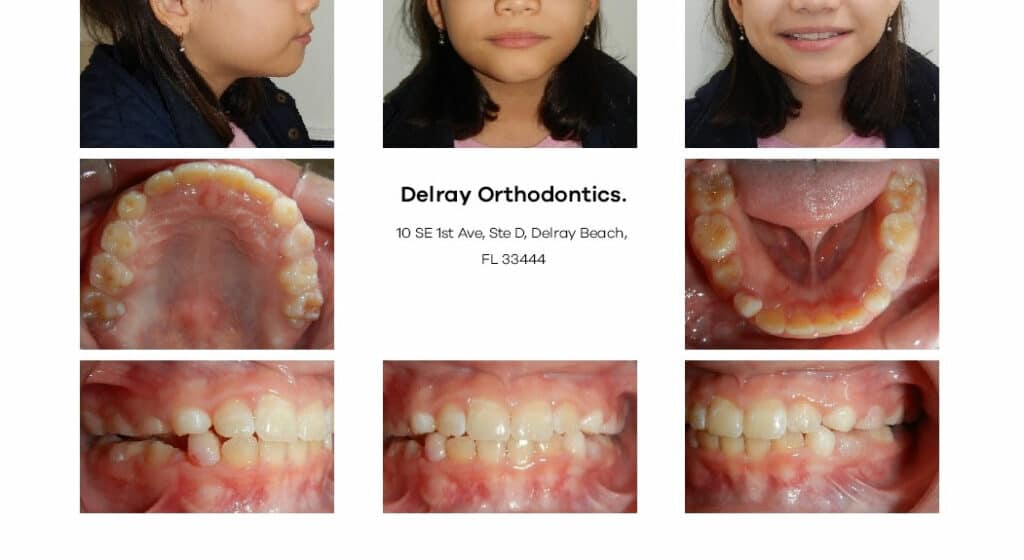 Delray Orthodontics Dental