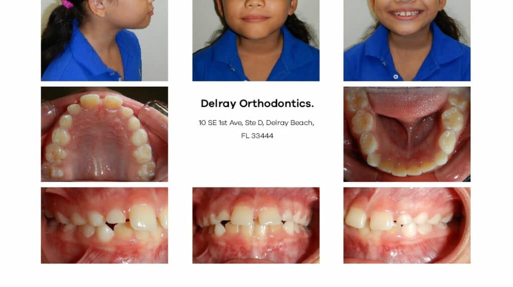 Delray Orthodontics Dental