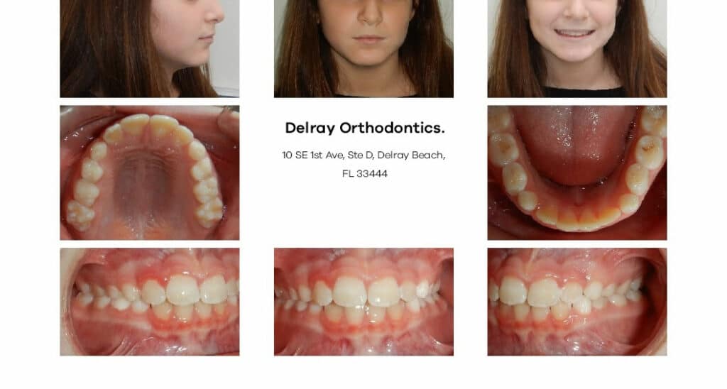 Delray Orthodontics Dental