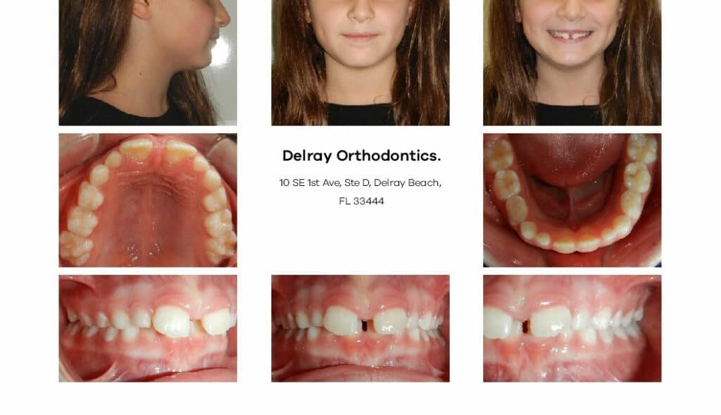 Delray Orthodontics Dental