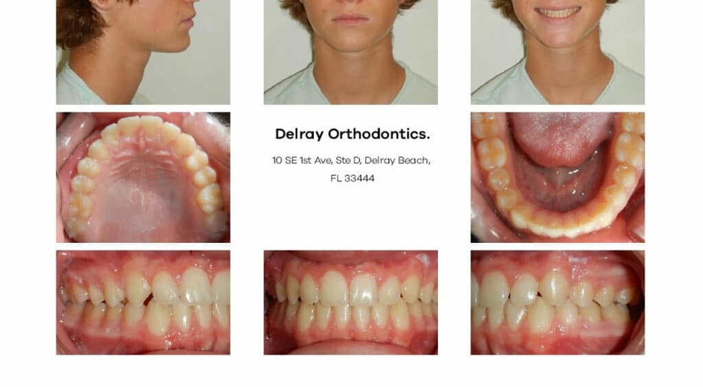 Delray Orthodontics Dental