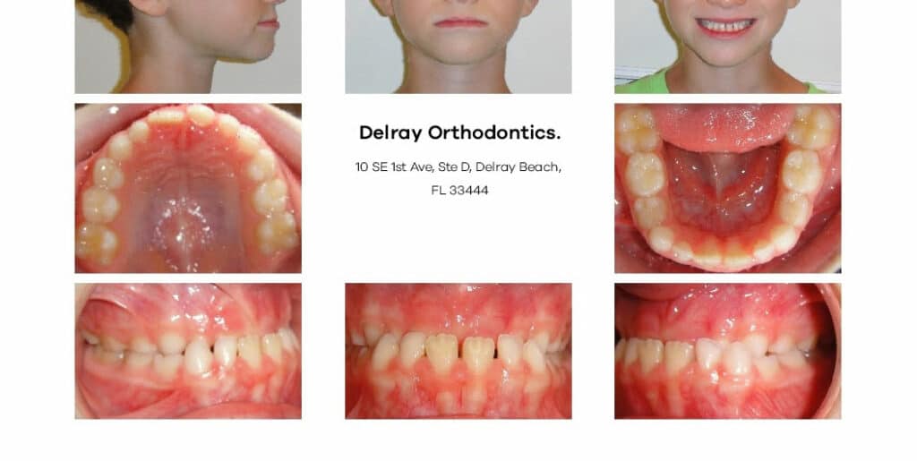 Delray Orthodontics Dental
