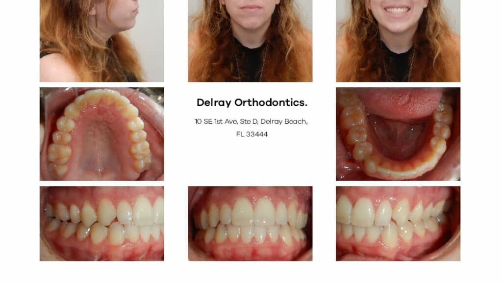 Delray Orthodontics Dental