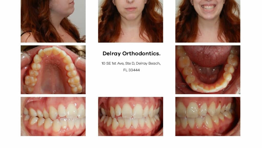 Delray Orthodontics Dental