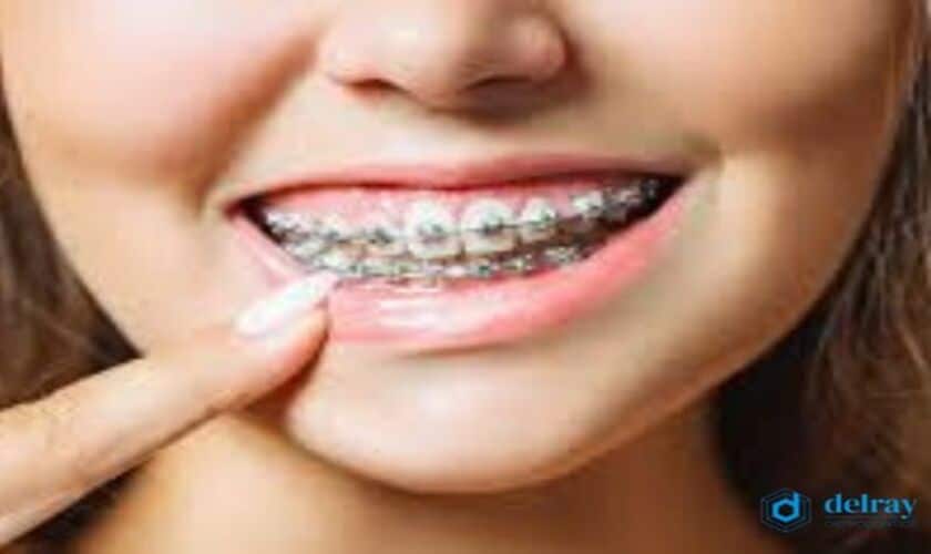 Invisalign in Delray