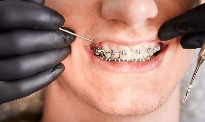 Orthodontist in Delray