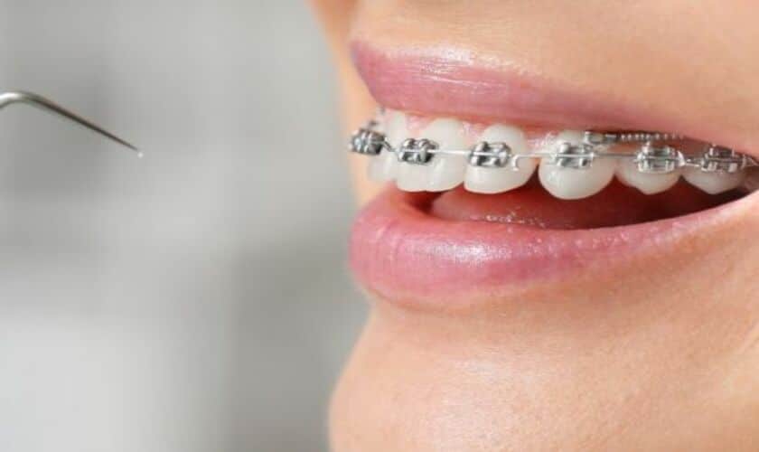 Delray Beach Orthodontist