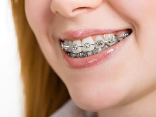 Orthodontist in Delray Beach