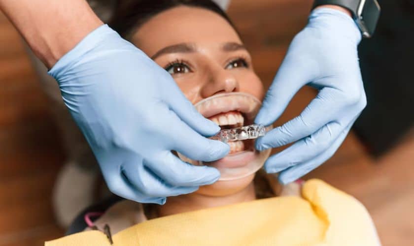 Invisalign Aligner Delray Beach