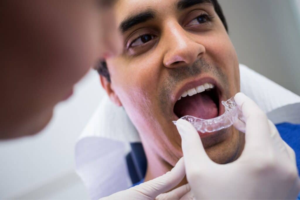 Invisalign Aligner in Delray Beach