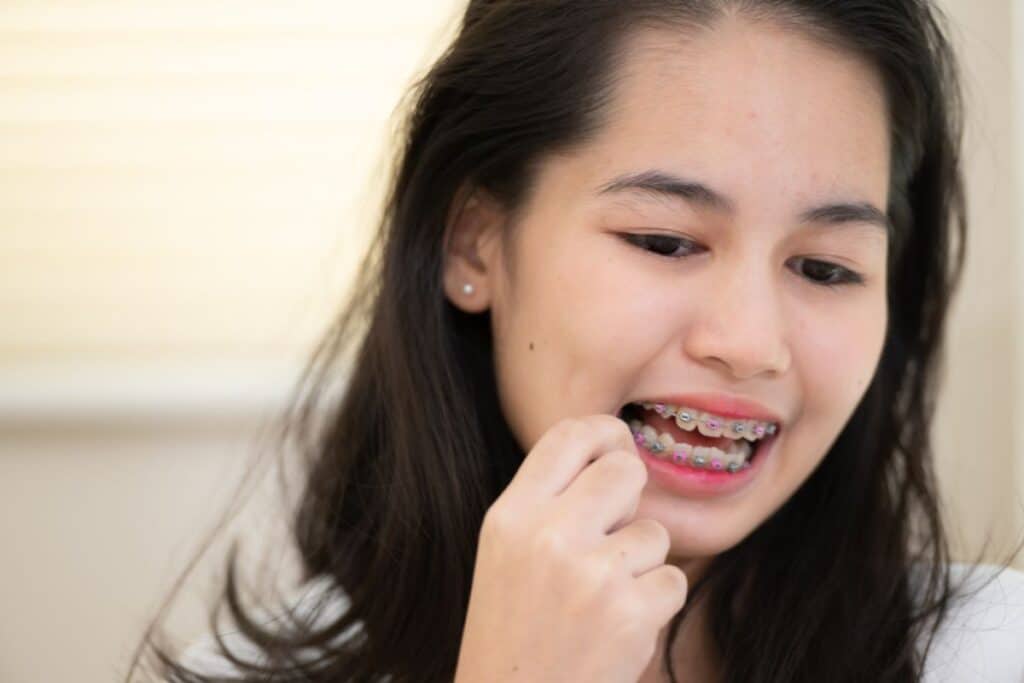 Orthodontic Treatment Delray Beach