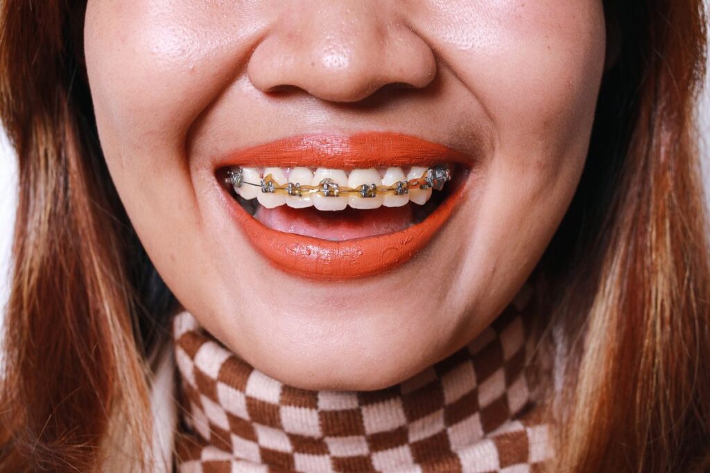 Orthodontist Treatment Delray Beach