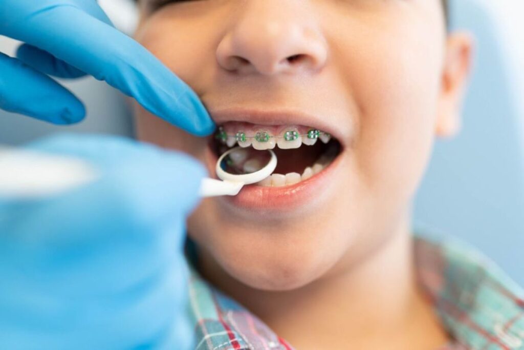 Orthodontist in Delray Beach