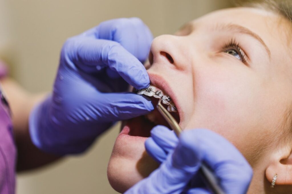 Orthodontic Treatment Delray Beach
