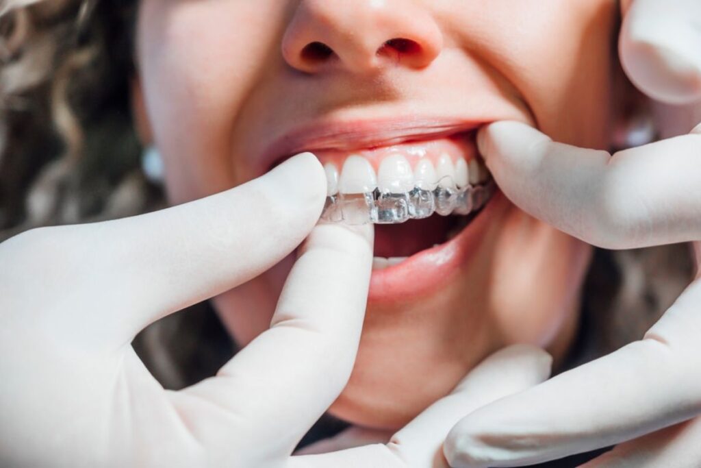 Invisalign Near Me Delray Beach