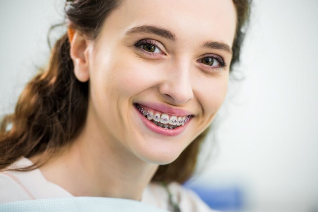 Clear Braces Delray Beach