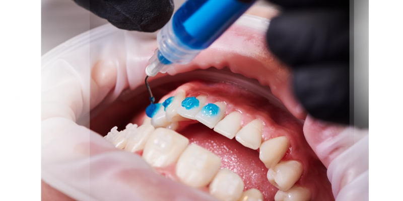 Orthodontist Near Boynton Beach