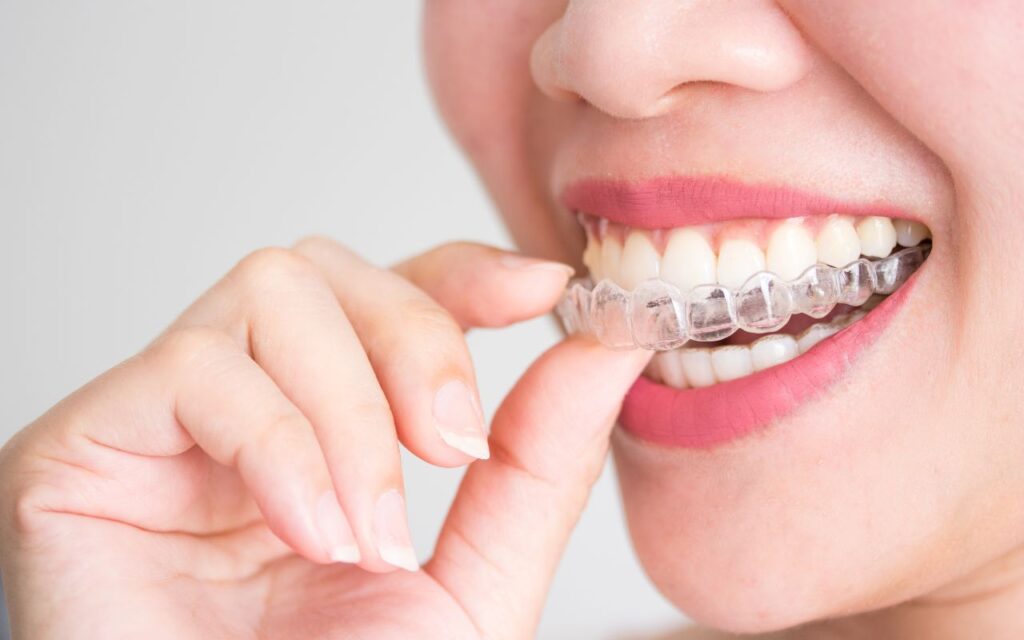 Person inserting clear orthodontic aligner into mouth against white background.