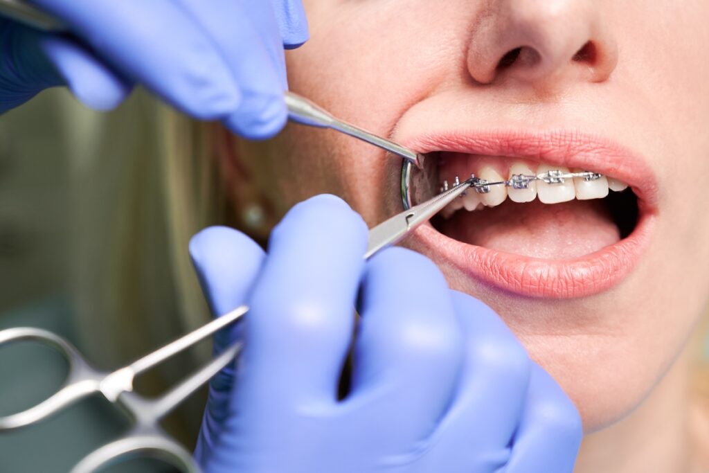The Evolution Of Orthodontists: From Braces To Digital Scans