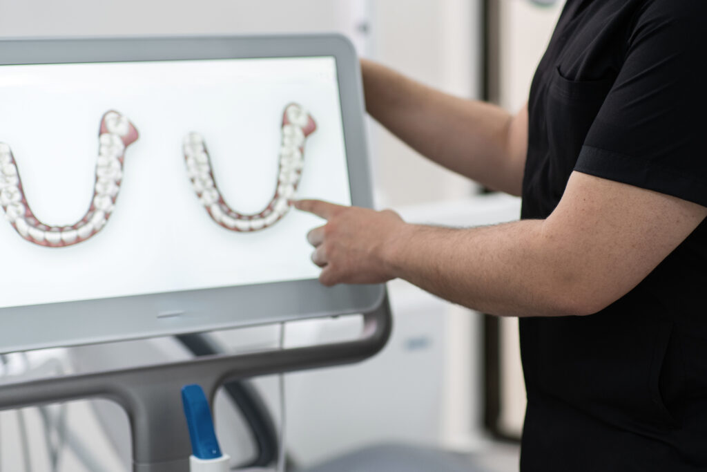 Step-by-Step Guide to Precise Tooth Movement by an Orthodontist