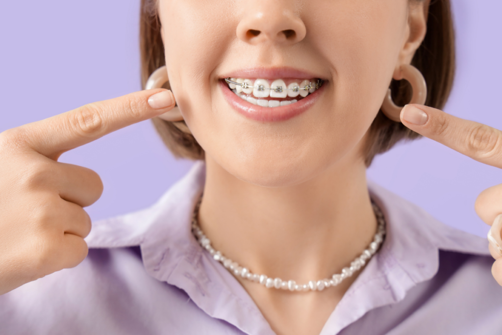 Orthodontic Treatment for Overbite, Underbite, and Crossbite