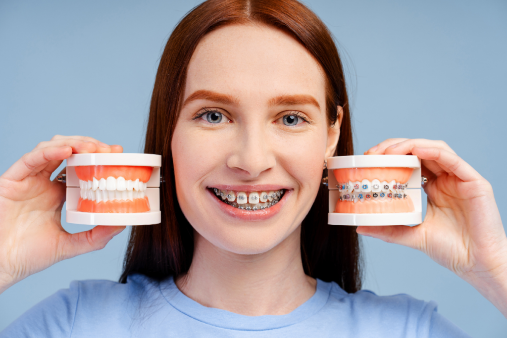 Understanding the Different Types of Braces: Which Orthodontic Option Is Right for You?